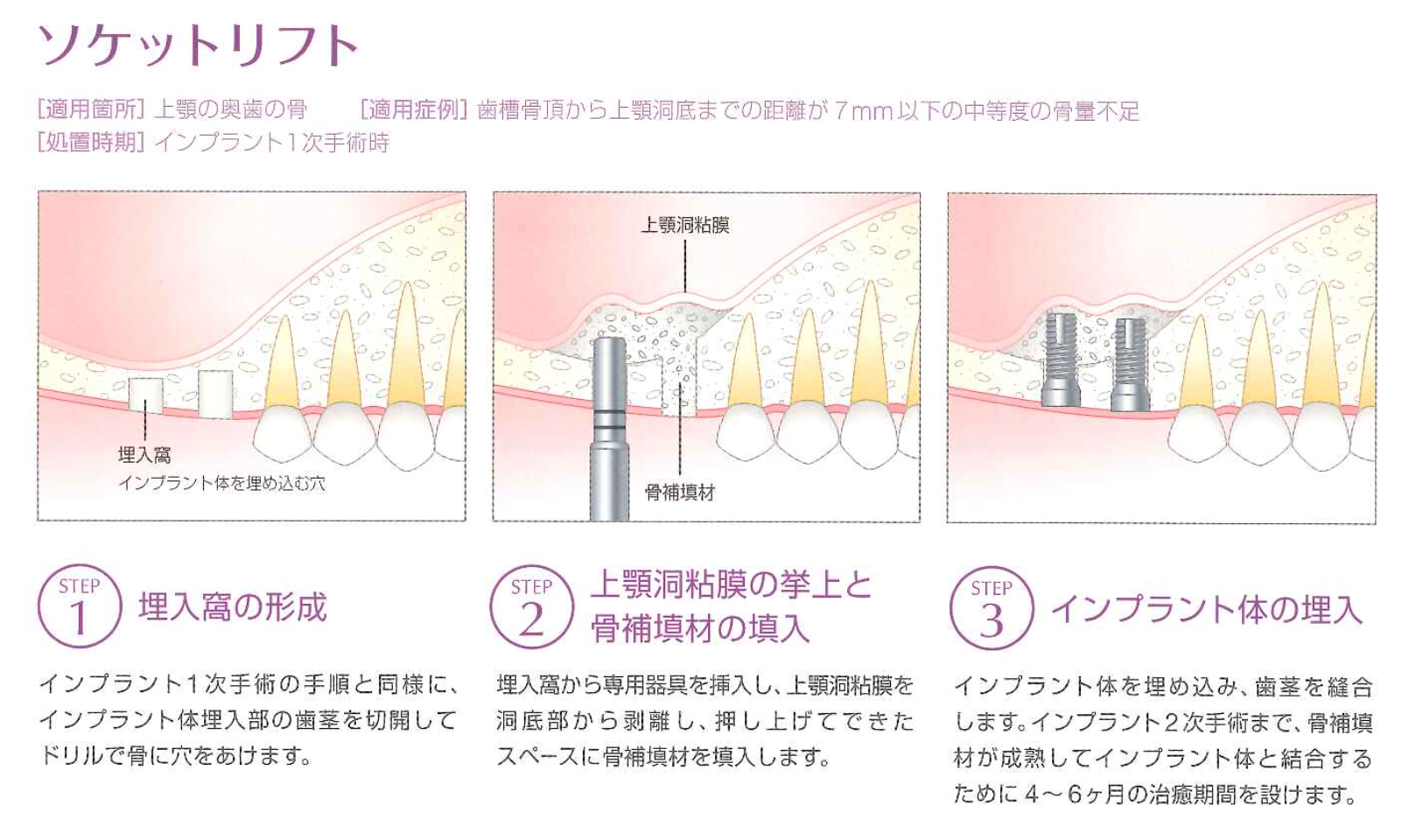 スクリーンショット 2017-09-14 10.01.19