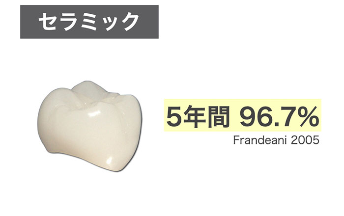 被せ物は一生ものじゃない？何年もつの？ - 新浦安の歯医者・歯科