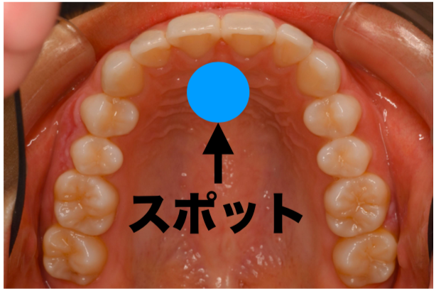 スクリーンショット 2020-01-21 10.50.16