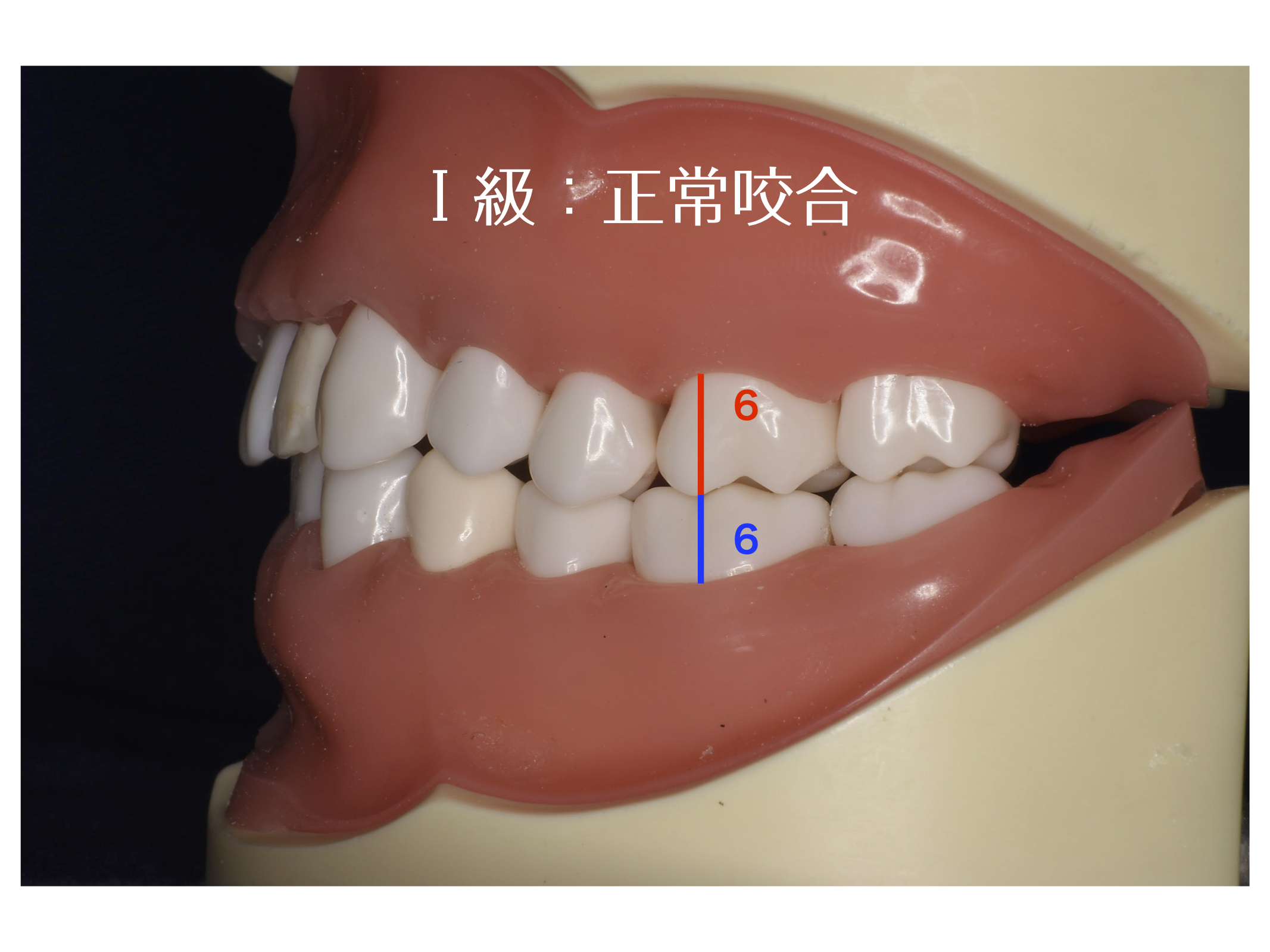 小児矯正について 新浦安の歯医者 歯科なら栗林歯科医院 小児矯正について 新浦安の歯医者 歯科なら栗林歯科医院